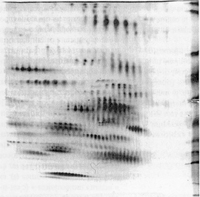 gel d'electrophorese bidimensionnel